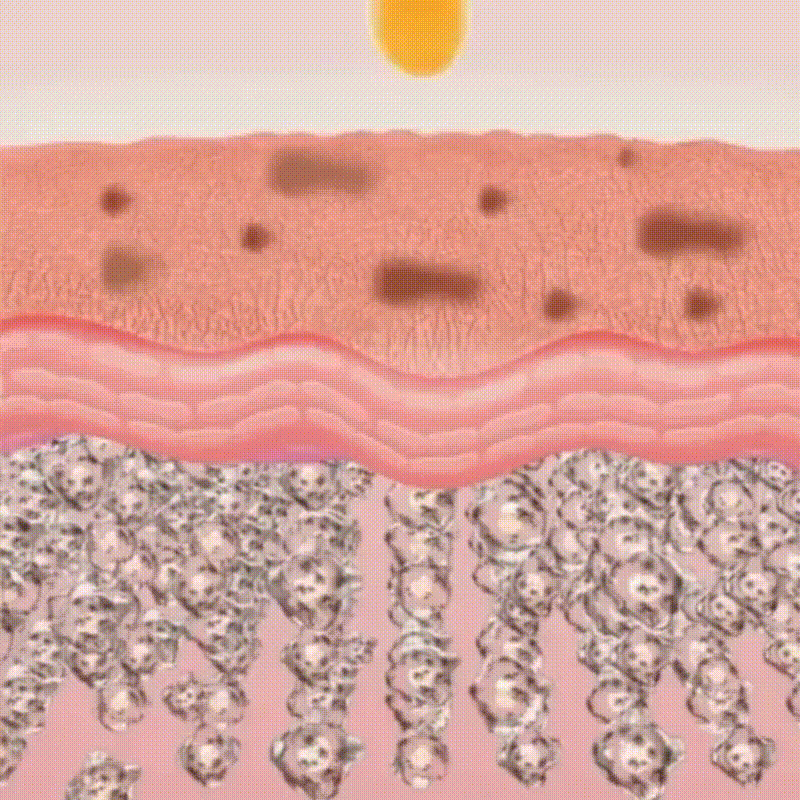 Ciberžolės serumas nuo pigmentinių dėmių - Originalu-pigu