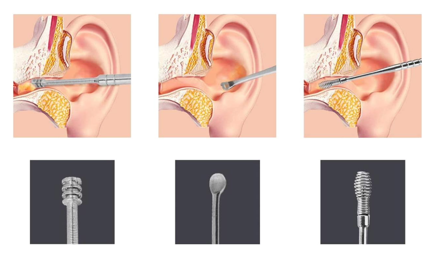 Nešiojamas ausų valymo rinkinys - Originalu-pigu