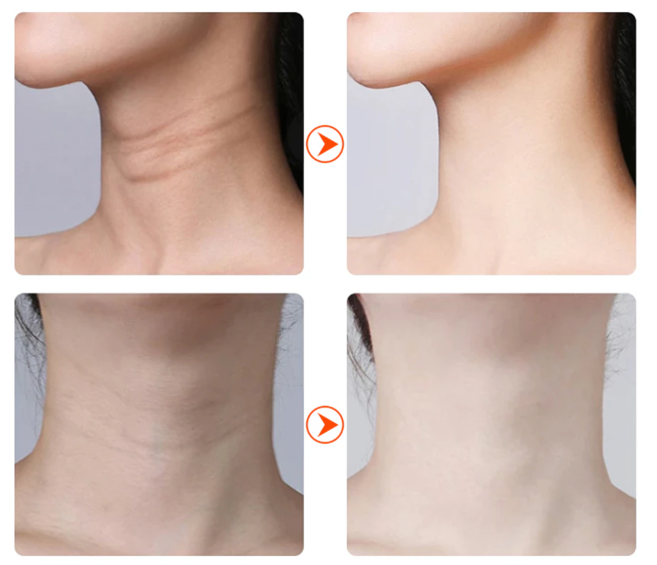 Veido odos stangrinimo prietaisas - Originalu-pigu