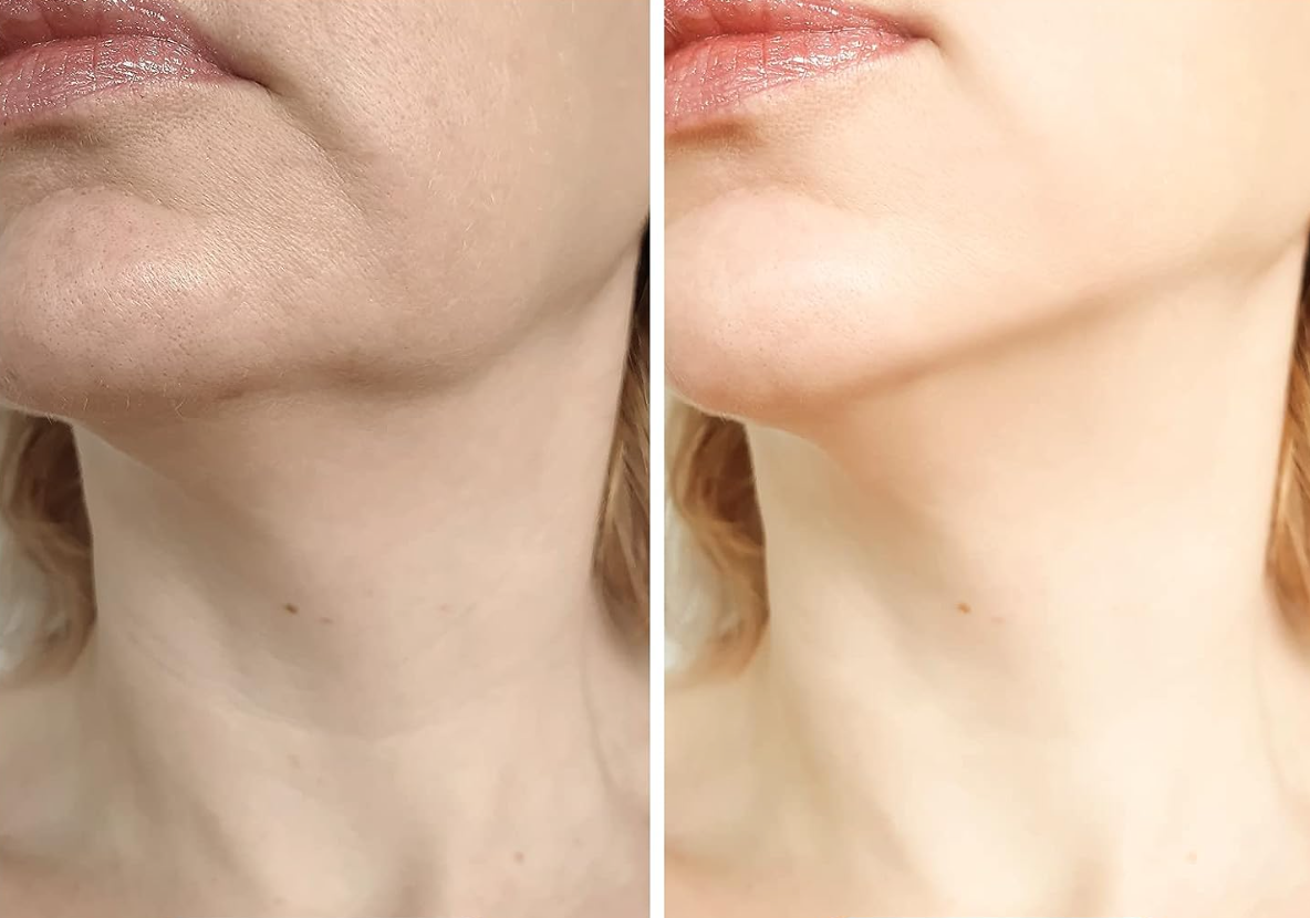 Veido odos stangrinimo prietaisas - Originalu-pigu