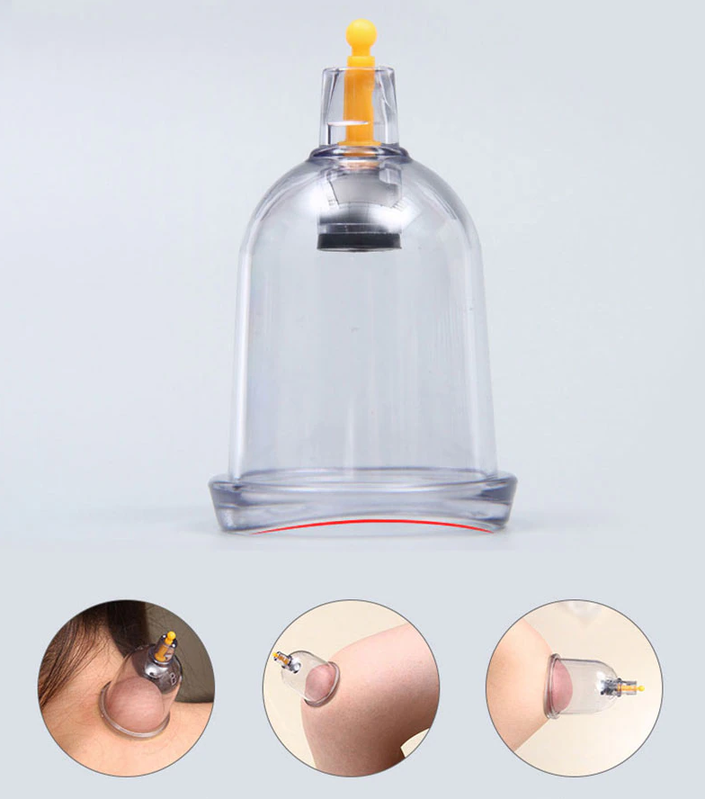 Vakuuminio masažo taurelių rinkinys - Originalu-pigu