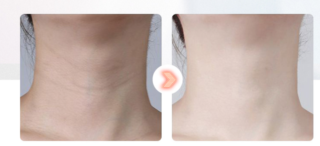 Elektrinis "Guasha" masažuoklis - Originalu-pigu