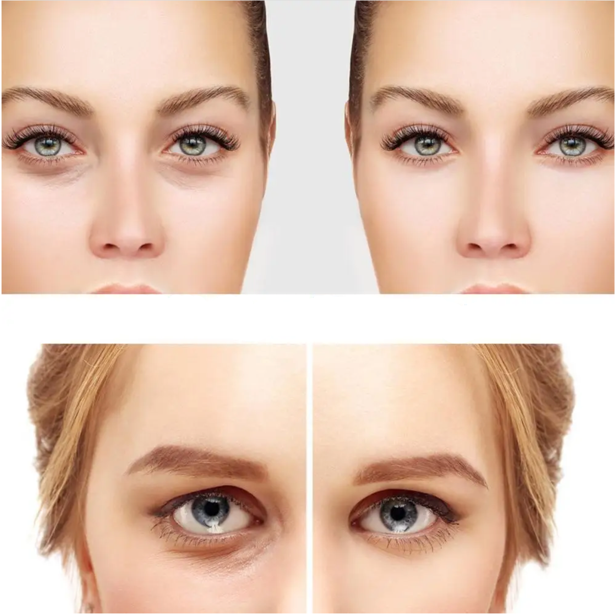 LED prietaisas paakių terapijai - Originalu-pigu