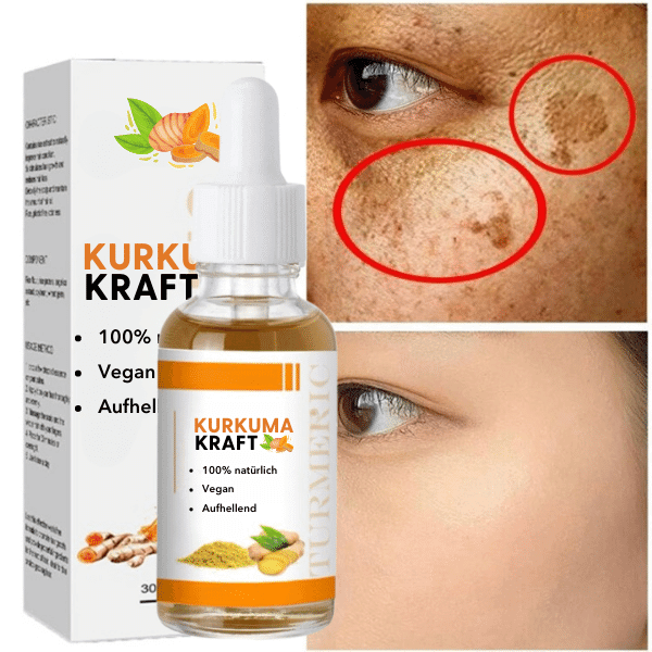 Ciberžolės serumas nuo pigmentinių dėmių - Originalu-pigu