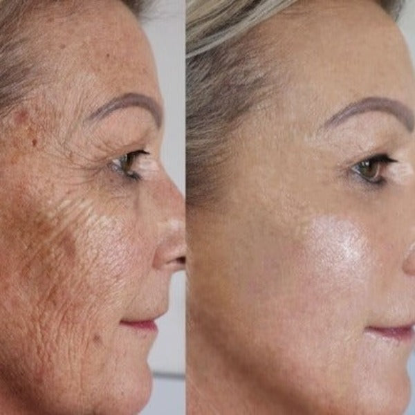 Ciberžolės serumas nuo pigmentinių dėmių - Originalu-pigu