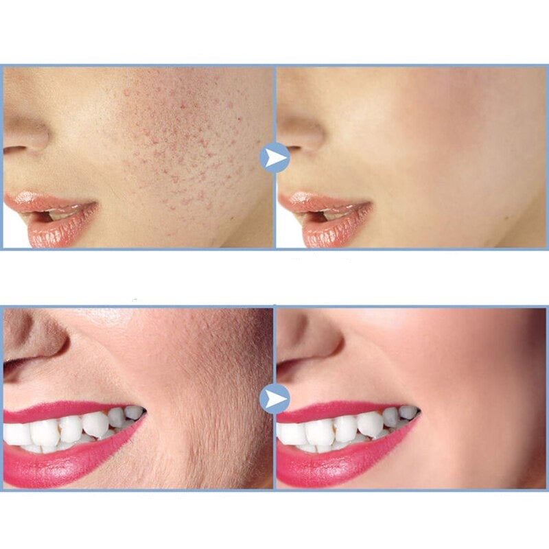 Lazdelė odos terapijai - Originalu-pigu