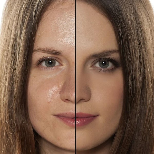 Veido blizgesį pašalinantis volelis (3 vnt.) - Originalu-pigu