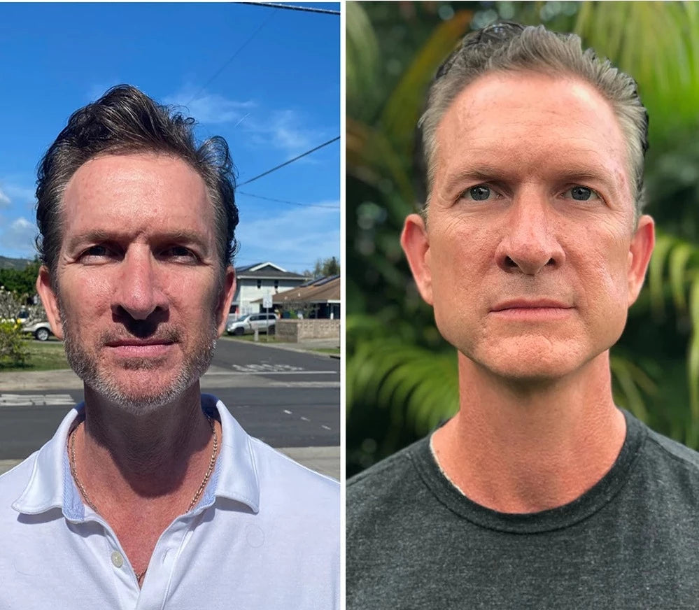 Žandikaulio raumenų lavinimo kamuoliukas (2 vnt.) - Originalu-pigu