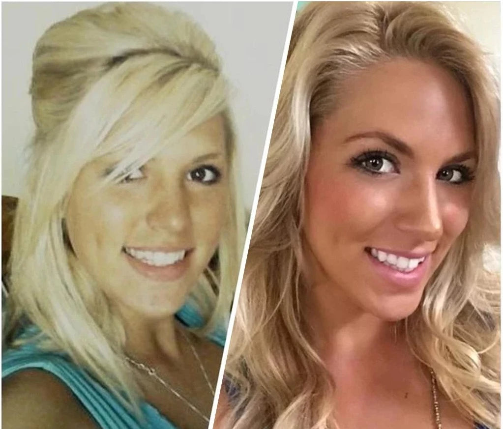 Žandikaulio raumenų lavinimo kamuoliukas (2 vnt.) - Originalu-pigu