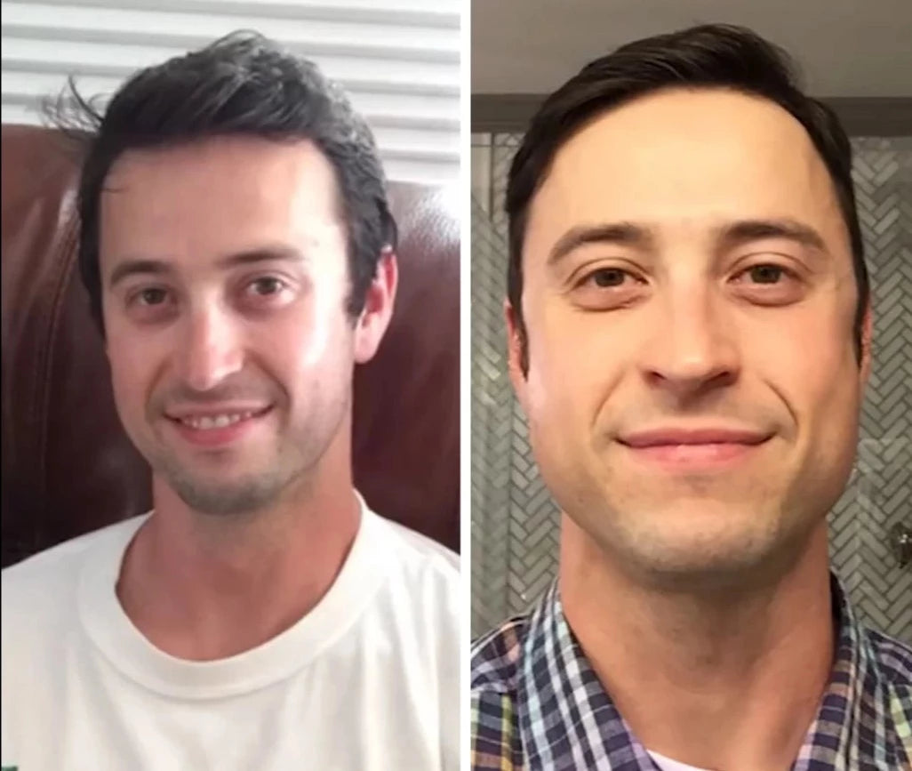 Žandikaulio raumenų lavinimo kamuoliukas (2 vnt.) - Originalu-pigu