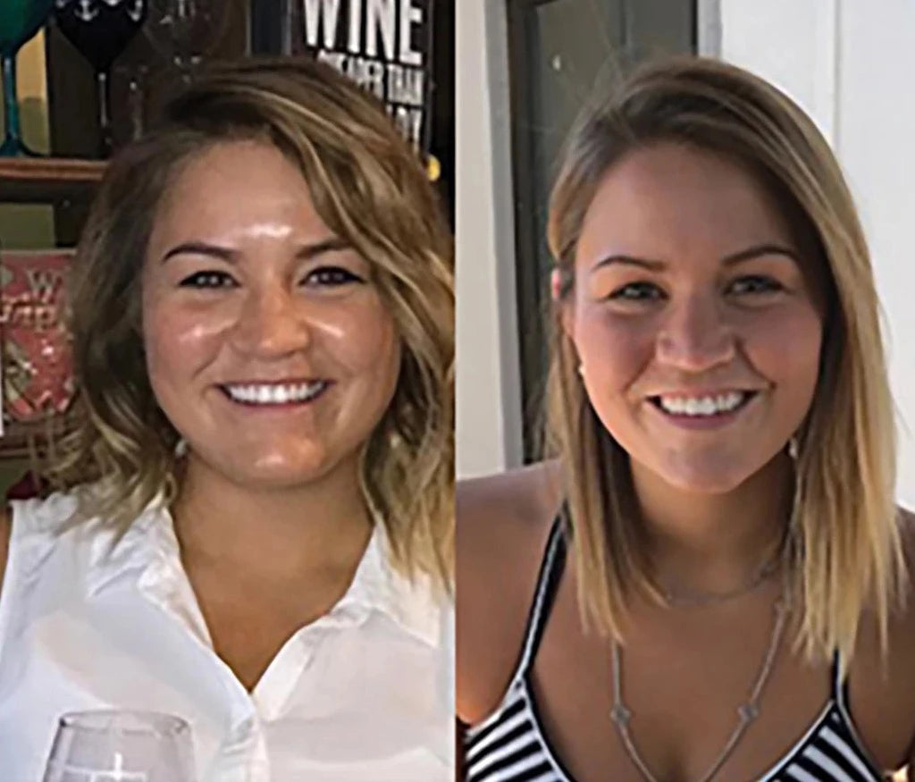 Žandikaulio raumenų lavinimo kamuoliukas (2 vnt.) - Originalu-pigu