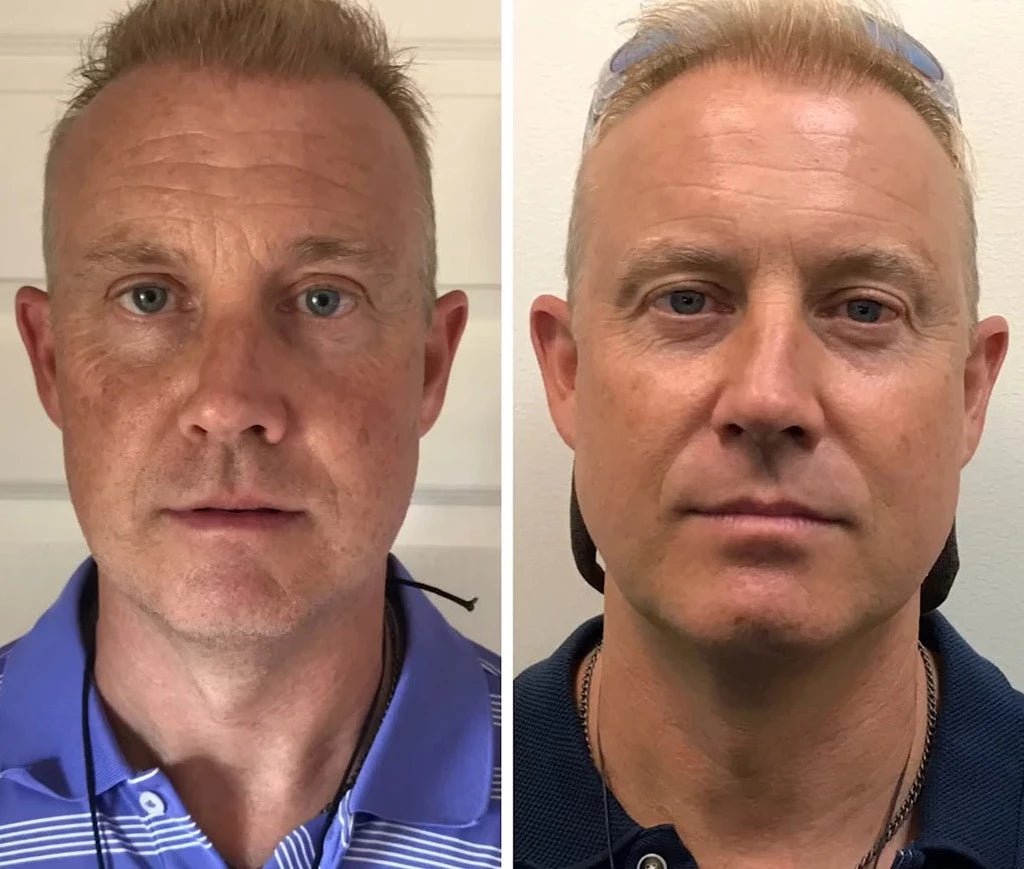 Žandikaulio raumenų lavinimo kamuoliukas (2 vnt.) - Originalu-pigu